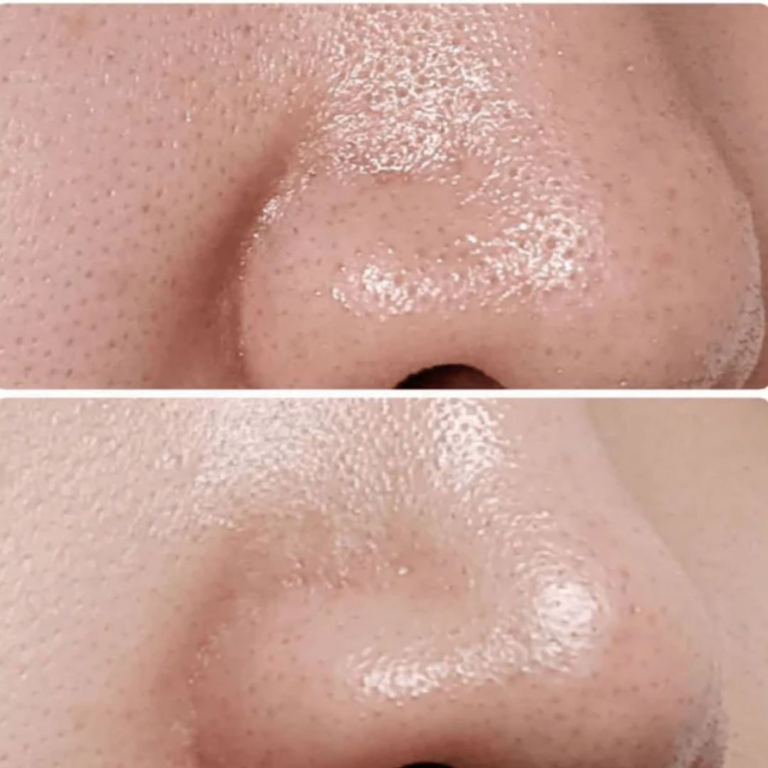 ANUA Heartleaf Pore Control Cleansing Oil - Image 5