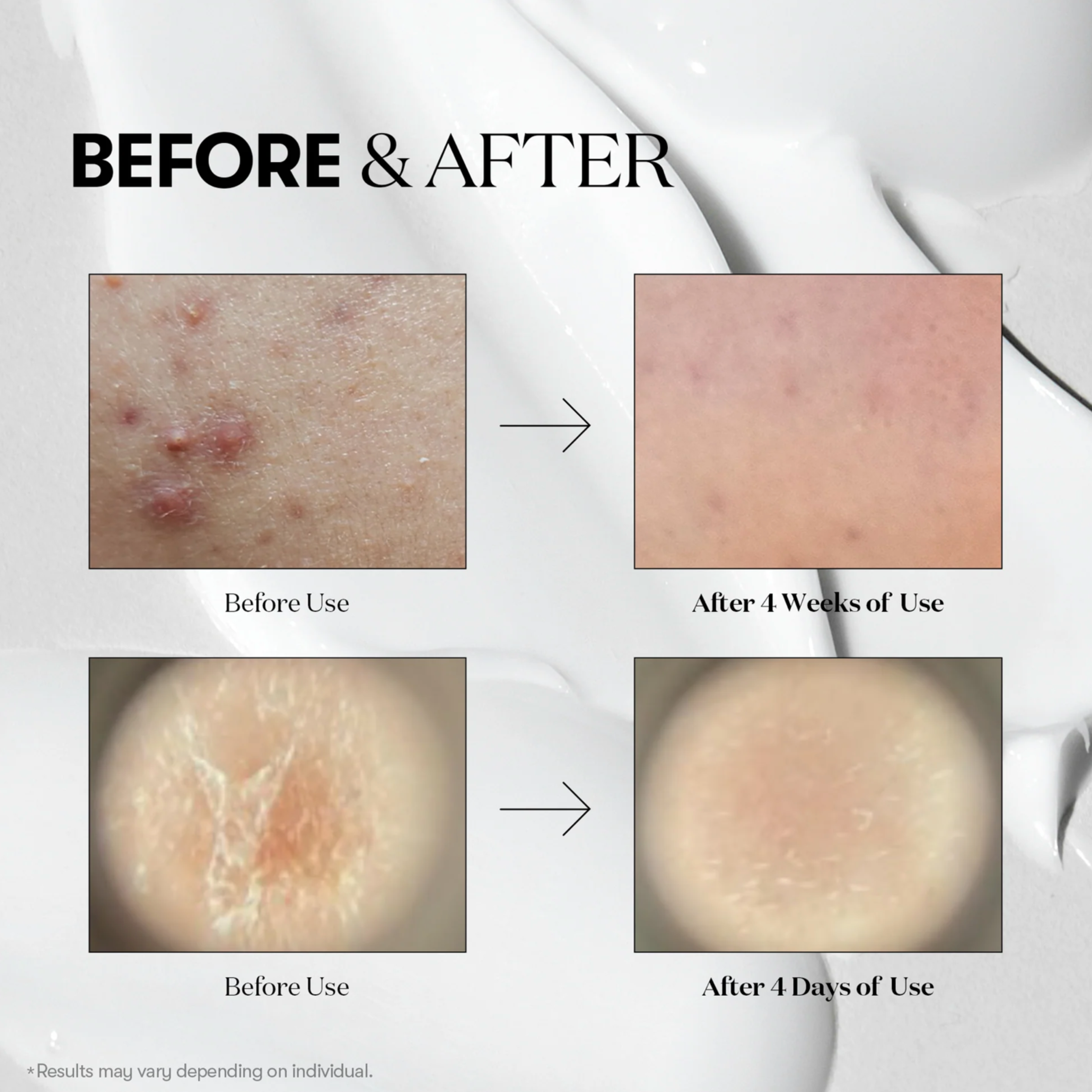 VT Reedle Shot 100 - Image 5